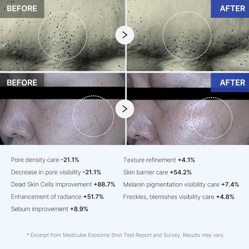 MEDICUBE One Day Exosome Shot2000